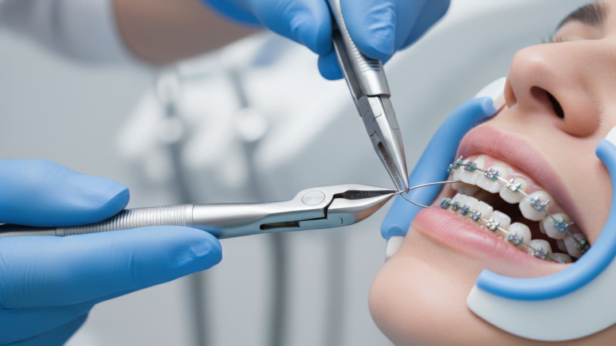 歯科医にワイヤー矯正を施術してもらっている患者