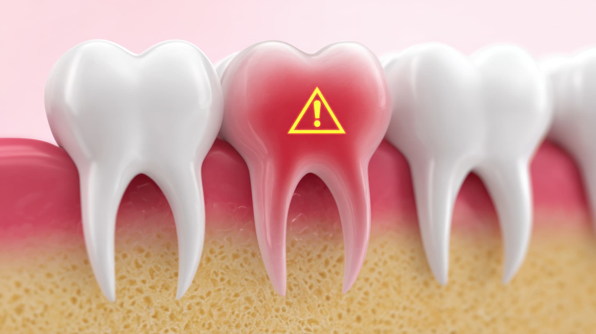 虫歯のリスクのイメージ