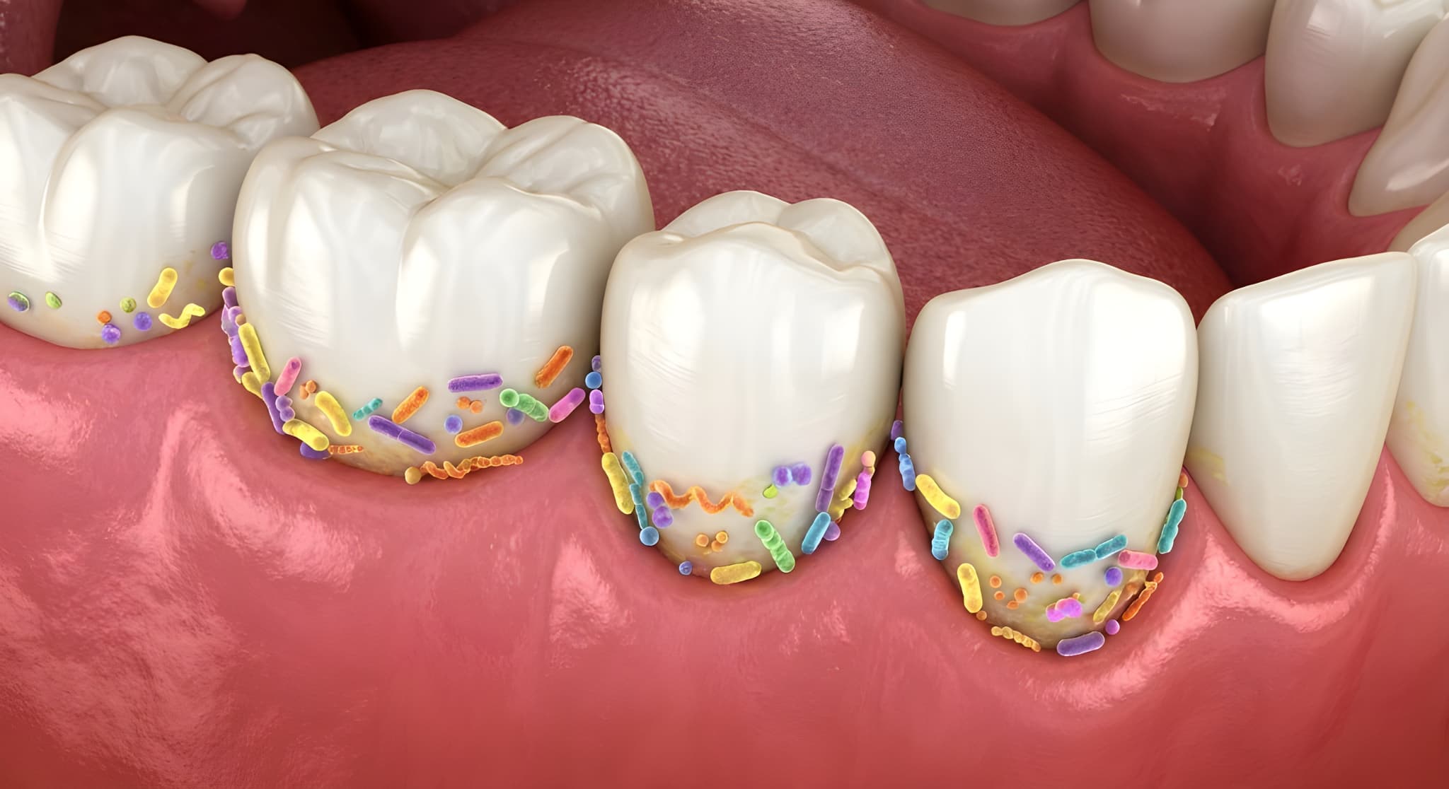 プラークの蓄積から菌が増える様子