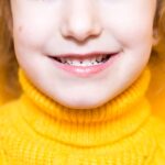 受け口の子どもの口元