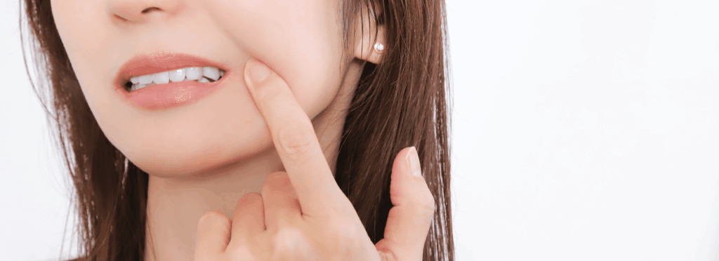 歯ぎしり・食いしばりセルフチェック｜くつい歯科