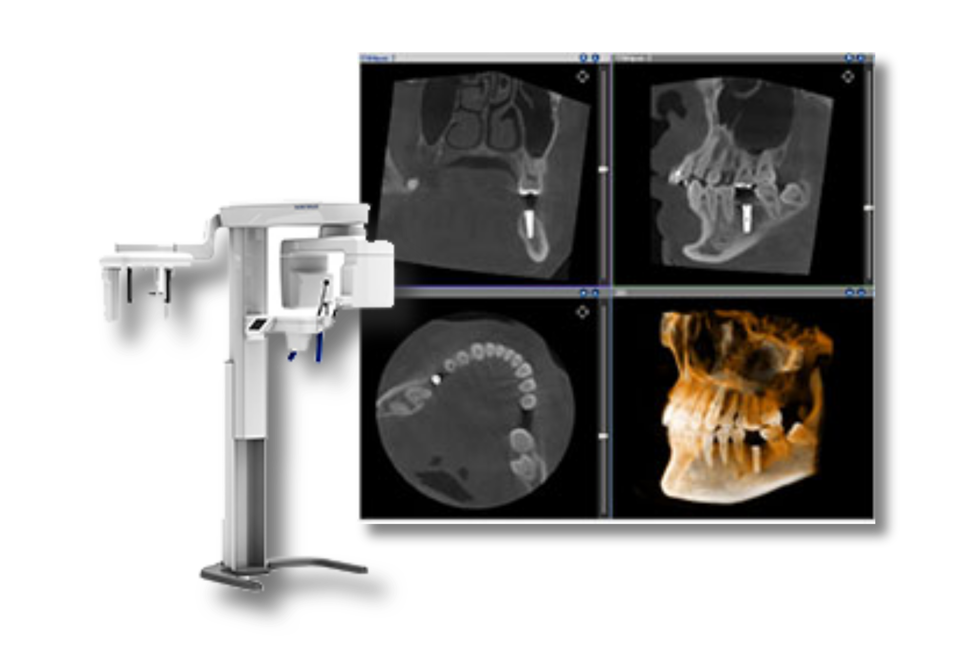 CT 3D画像診断｜くつい歯科