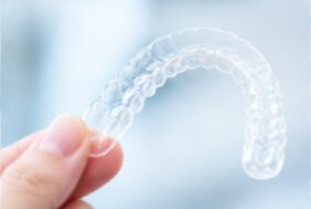 歯の矯正用のマウスピースを持つ手